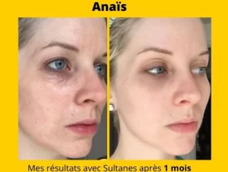 Les-Bienfaits-de-lHuile-de-Pepin-de-Figue-de-Barbarie