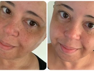 Augustinus Bader avant/après