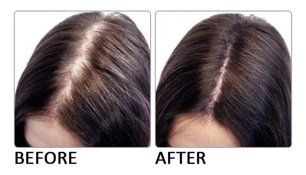 huile de romarin cheveux avant/après