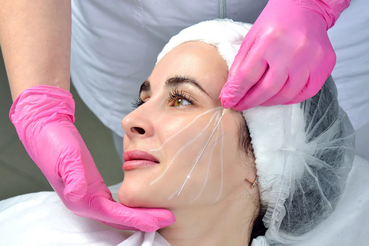 fils-de-soie-collagene-avant-apres