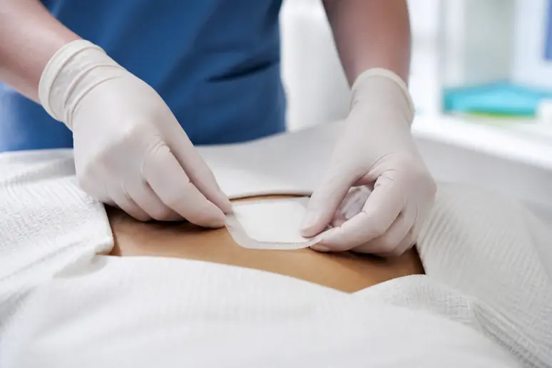 Suivi post-opératoire du mont de Vénus femme : bandage et guérison après intervention chirurgicale.